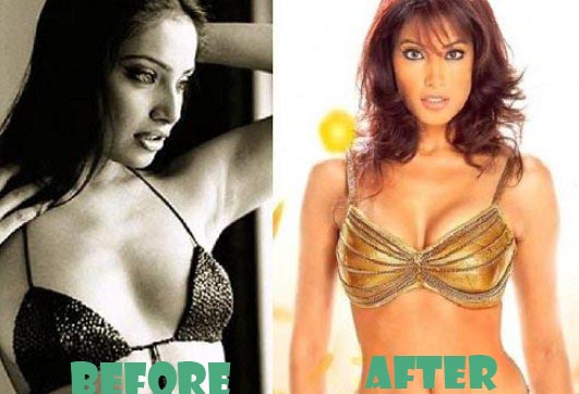 Bipasha Basu Plastic Surgery Before And After