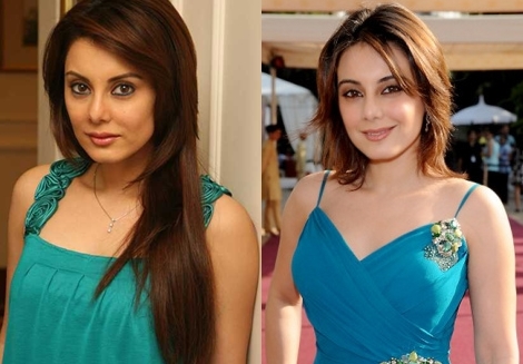 Minissha Lamba Plastic Surgery Before And After Breasts Implants